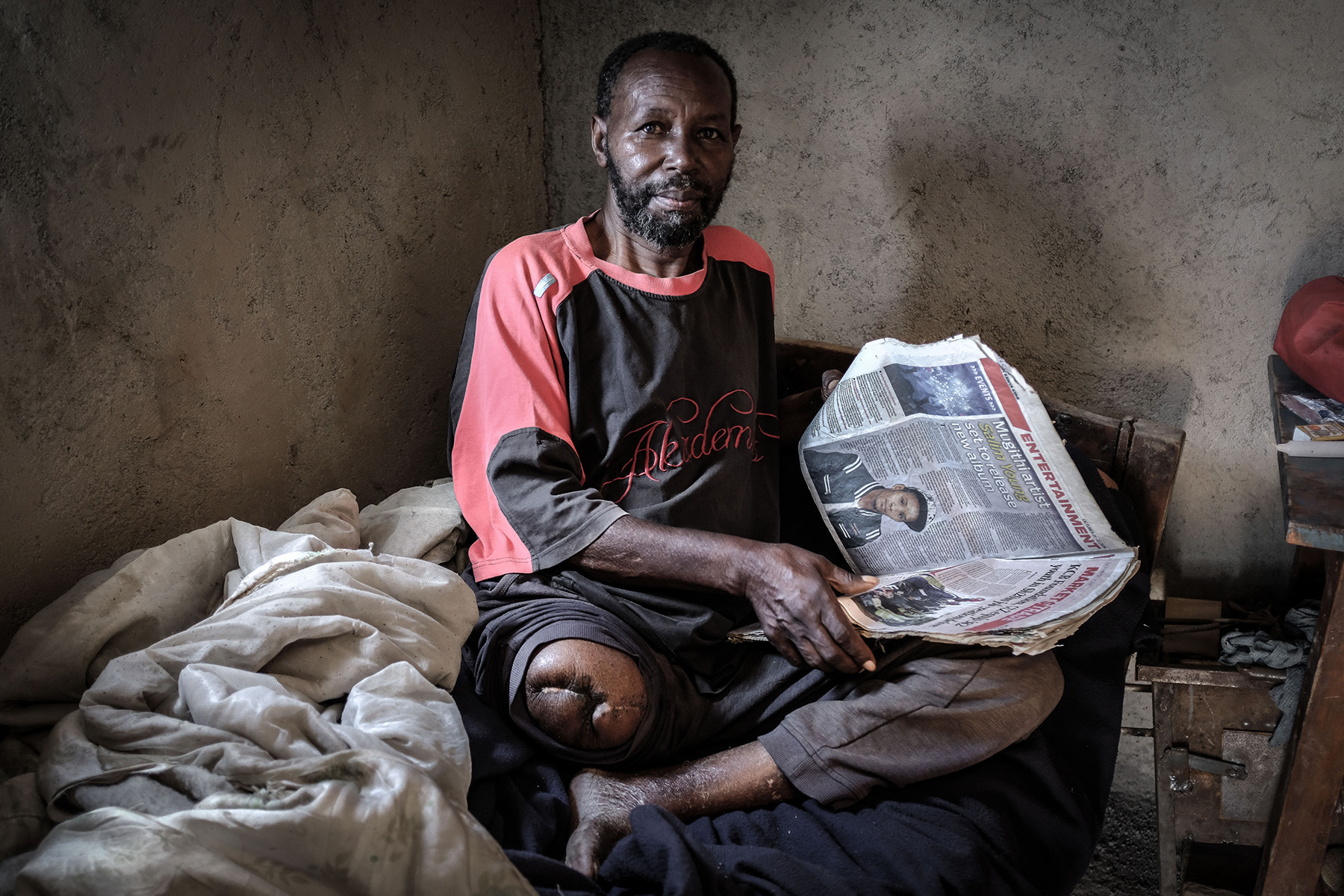 A man in a black and red shirt sits on his bed in the Kibera slums of Nairobi, Kenya. He is holding a newspaper, looking at the camera. His right leg has been amputated..
